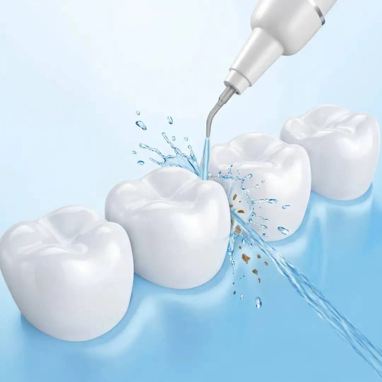 جرمگیر دندان گرین لاین مدلUltraSonic